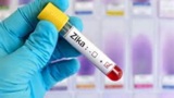 Más de dos mil casos de zika en América
