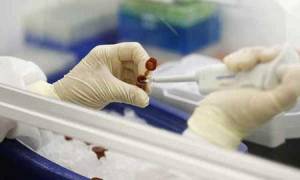 Good results of therapeutic vaccines against cancer in Camaguey