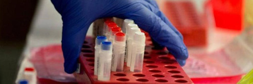 Crean en Cuba nuevo medicamento contra el cáncer cutáneo