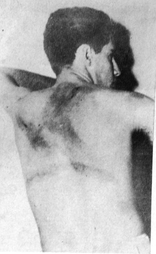 Los verdugos de la dictadura se ensañaron con la espalda de Gayol.