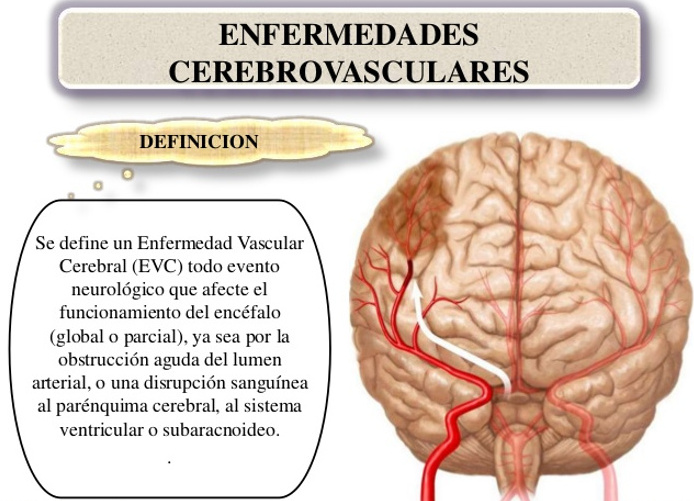 Patologìa vascular cerebral