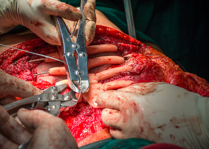 Surgical procedure for the first time in Cuba (+ Gallery) 