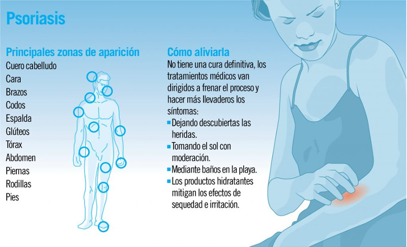 Imagen: Tomada de canalsalud.imq.es