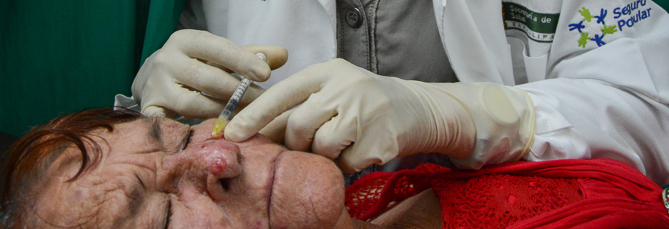 Efectividad del HeberFERON ante el cáncer de piel basocelular