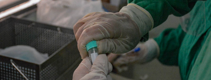 Más de doscientos casos nuevos de COVID-19 en los últimos 15 días