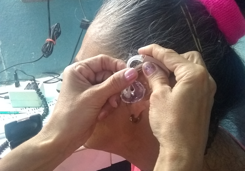 Mantiene Camagüey venta de prótesis auditivas