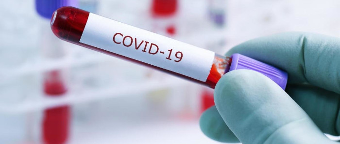 Aclara dudas sobre la COVID-19 viróloga del IPK