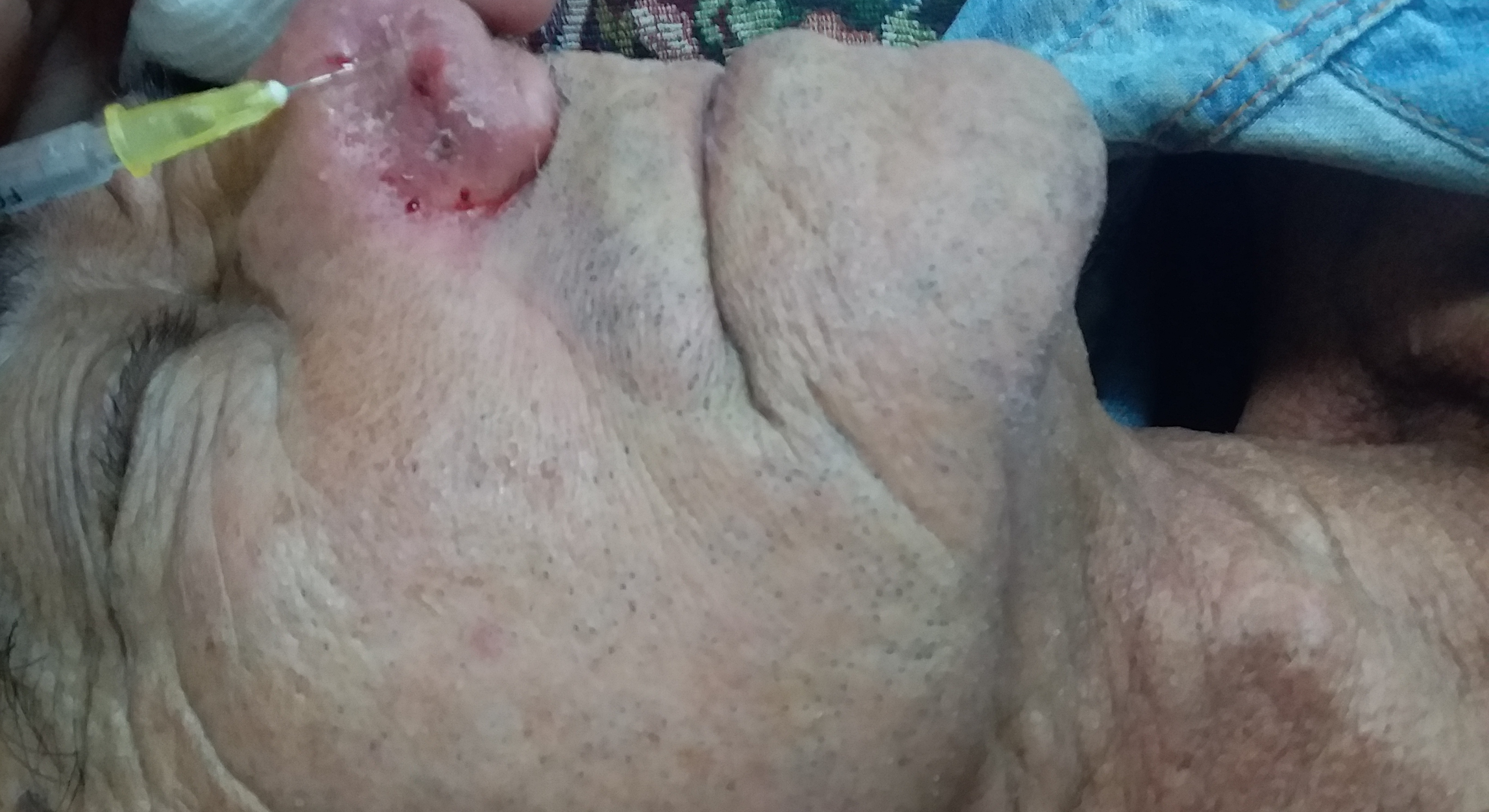 Preámbulo de Jornada Provincial de Dermatología 2020