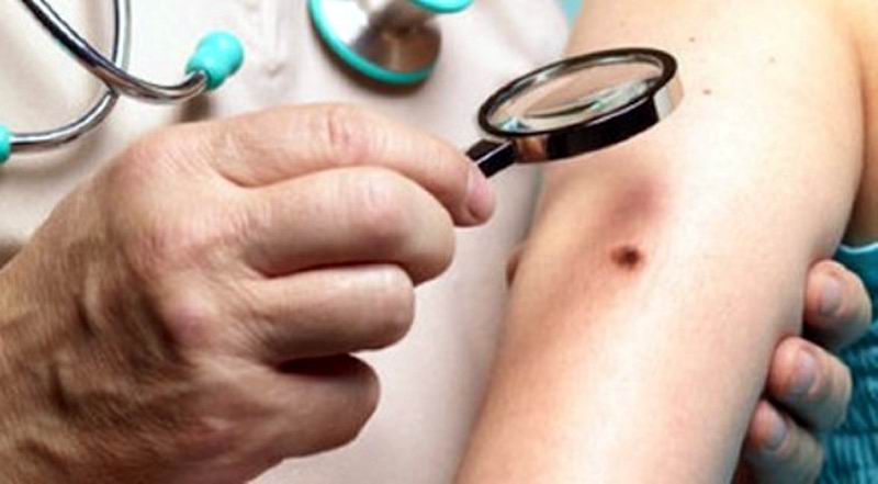 Dos días de Dermatología intensa
