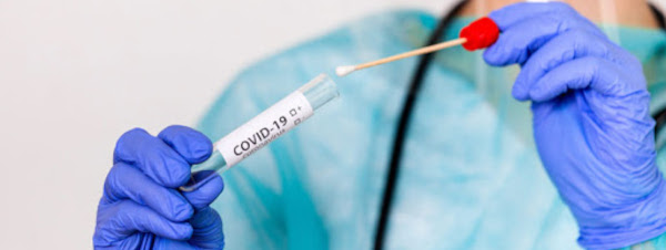 Actualizan protocolo para el diagnóstico y el manejo clínico de  confirmados, sospechosos y contactos de COVID-19