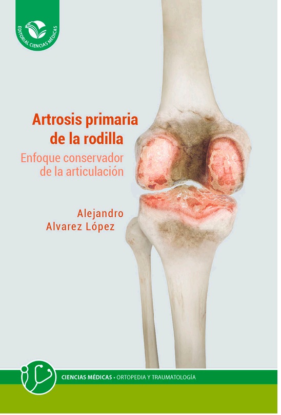 Nuevo texto sobre artrosis primaria de la rodilla