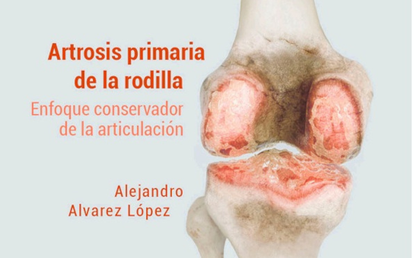 Nuevo texto sobre artrosis primaria de la rodilla