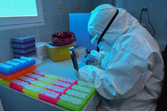 COVID-19: En Camagüey se puede controlar la situación    