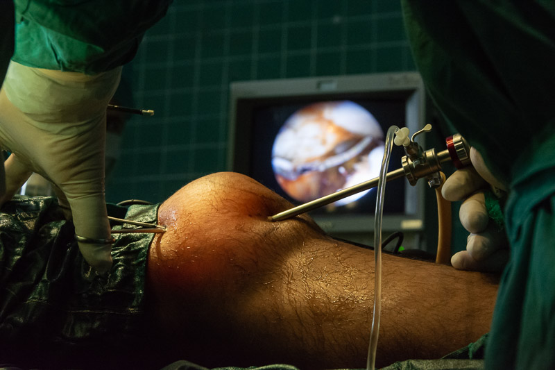 En Hospital Pediátrico: primeras operaciones de rodilla mediante artroscopia